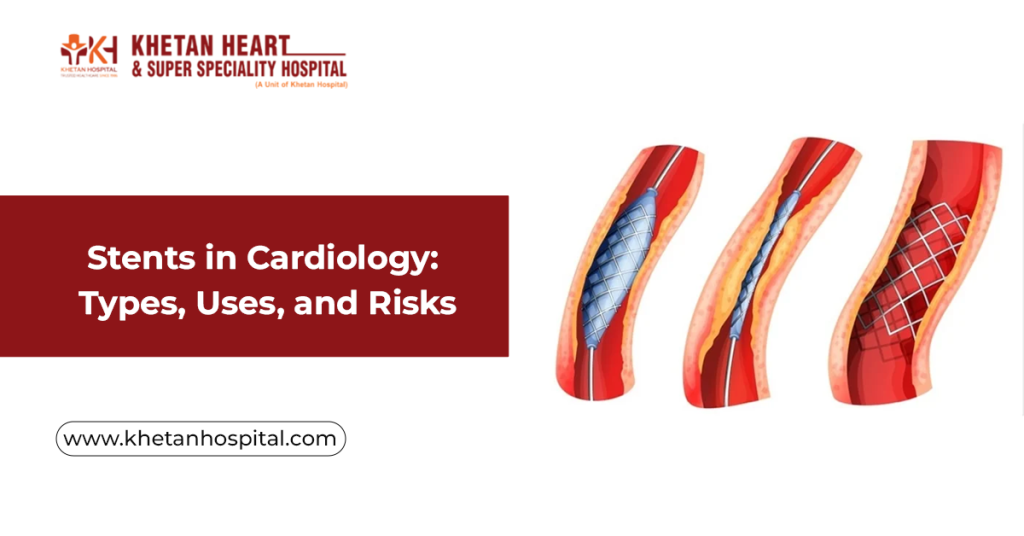 Stents in cardiology