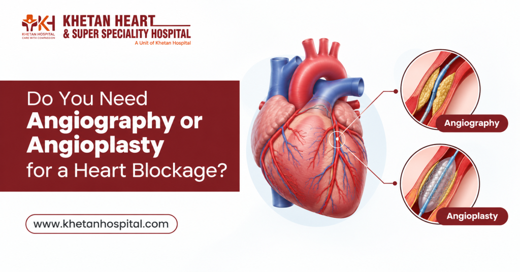 Angiography or Angioplasty
